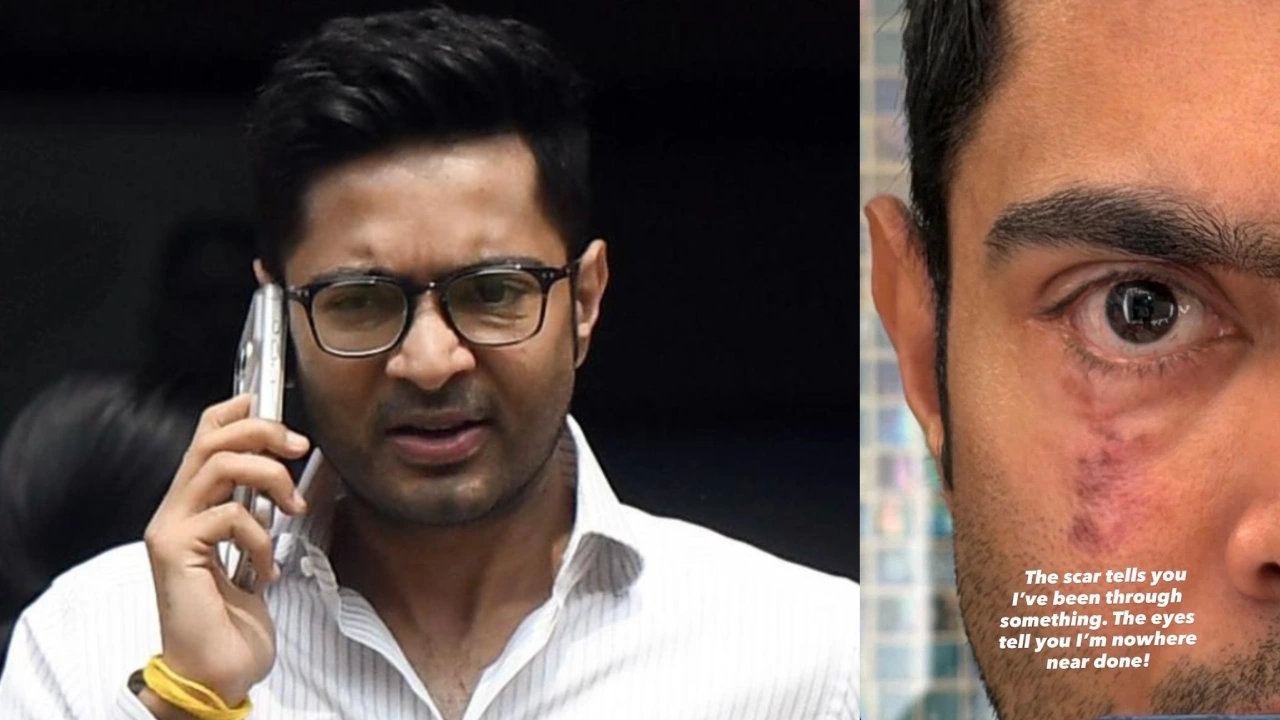 'এখনও শেষ হয়ে যায়নি', আমেরিকা থেকে চোখের ছবি পোস্ট করে ইঙ্গিতপূর্ণ বার্তা অভিষেকের! 